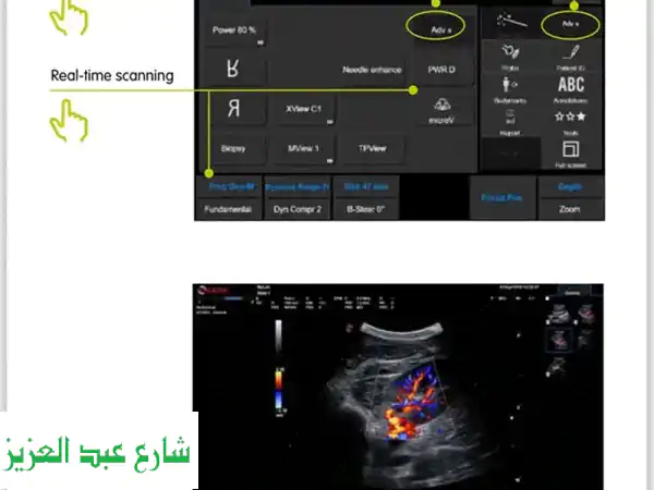 جهاز ايكو زاؤوتي (إيطالي) محمول - فرصة ذهبية لأطباء القلب بسعر لا يُفوّت!