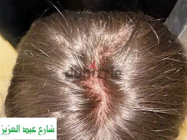 باروكات شعر طبيعي مستعملة للبيع - جودة عالية...