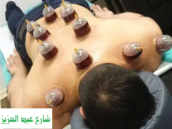 الحجامة العلاجية في Recovery Spa: تخلص من الألم واستعد حيويتك!