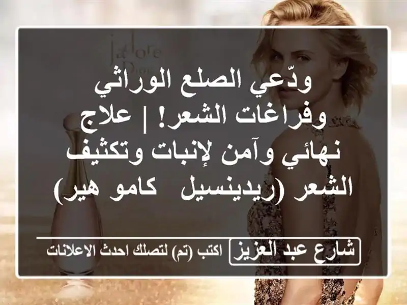 ودّعي الصلع الوراثي وفراغات الشعر! | علاج نهائي...